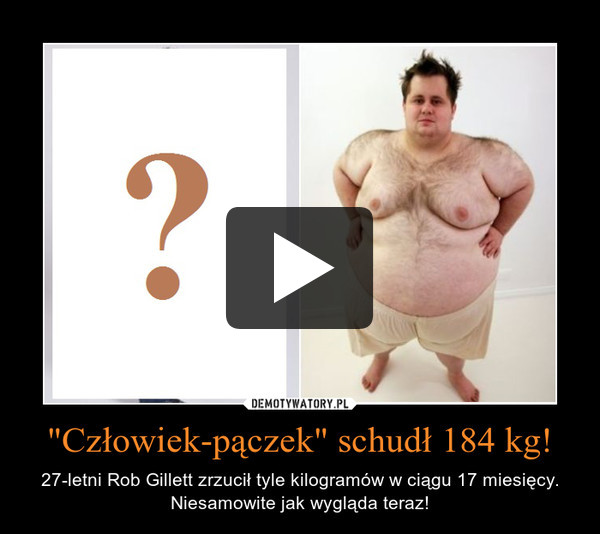 "Człowiek-pączek" schudł 184 kg! – 27-letni Rob Gillett zrzucił tyle kilogramów w ciągu 17 miesięcy. Niesamowite jak wygląda teraz! 