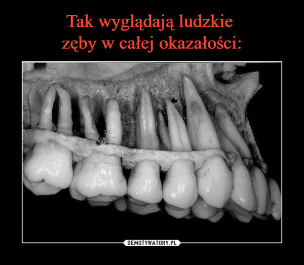 Tak wyglądają ludzkie 
zęby w całej okazałości: