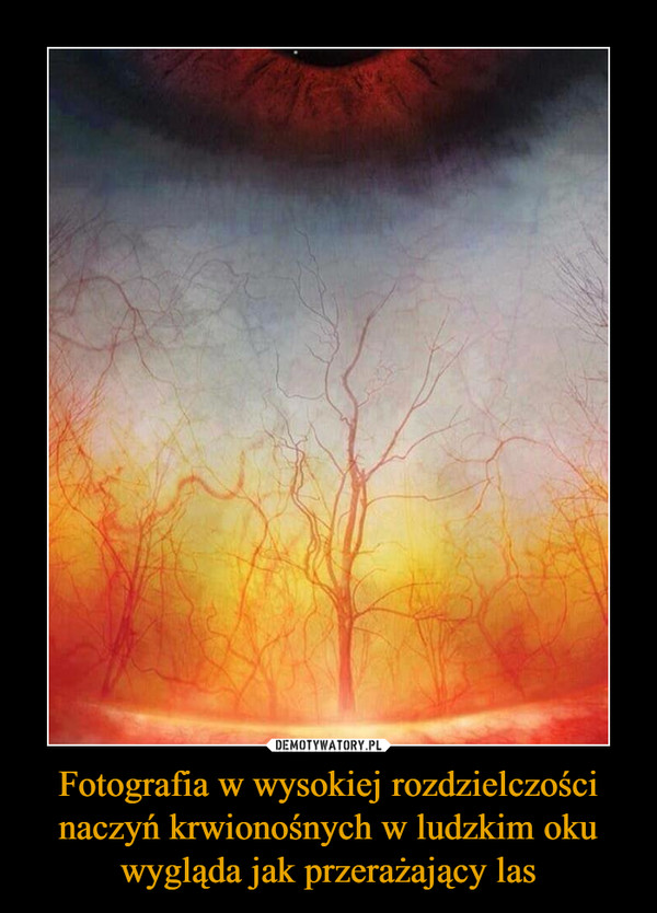 Fotografia w wysokiej rozdzielczości naczyń krwionośnych w ludzkim oku wygląda jak przerażający las