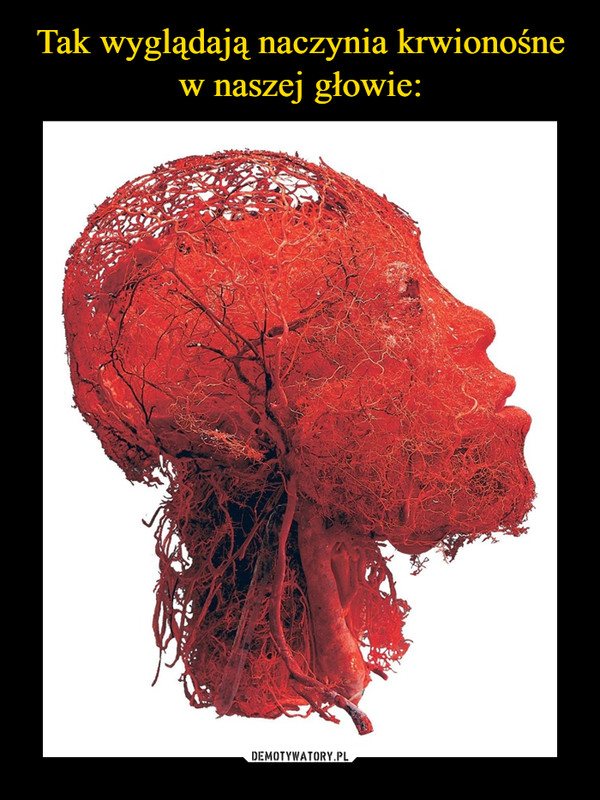 Tak wyglądają naczynia krwionośne w naszej głowie: