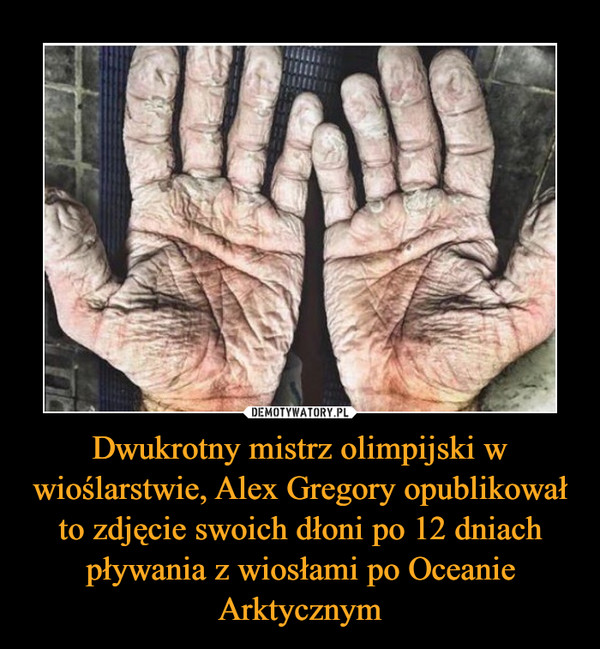 Dwukrotny mistrz olimpijski w wioślarstwie, Alex Gregory opublikował to zdjęcie swoich dłoni po 12 dniach pływania z wiosłami po Oceanie Arktycznym