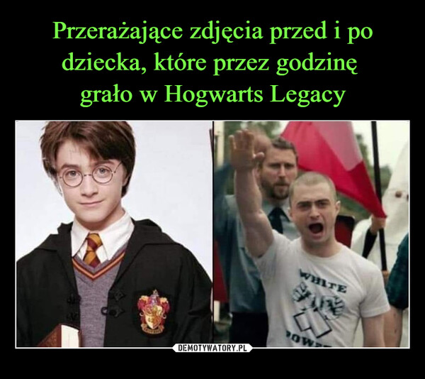 Przerażające zdjęcia przed i po dziecka, które przez godzinę 
grało w Hogwarts Legacy